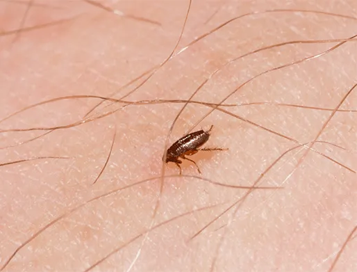 Dedetização de Pulgas no Alto da Mooca